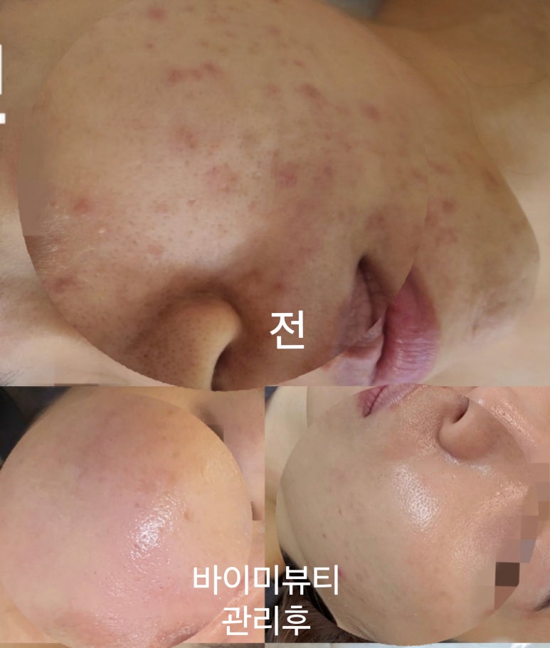 바이미뷰티 이미지