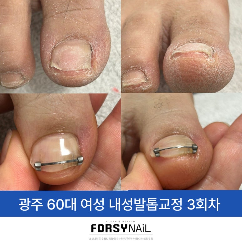 포쉬네일 이마트 광주점 이미지