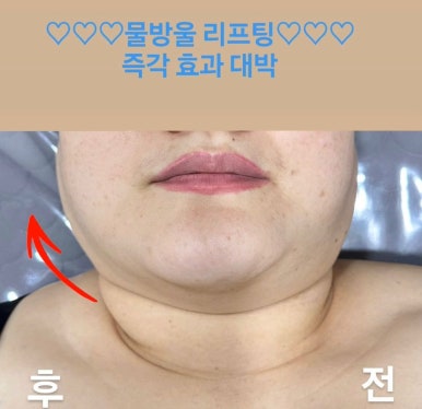 피부,맑음 이미지