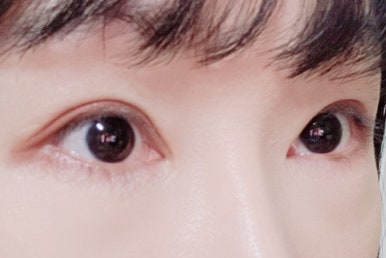 라임스킨케어 이미지