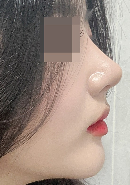 한코티에스 이미지