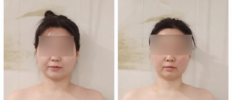 조암체형관리 이미지