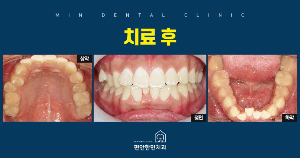 편안한민치과 이미지