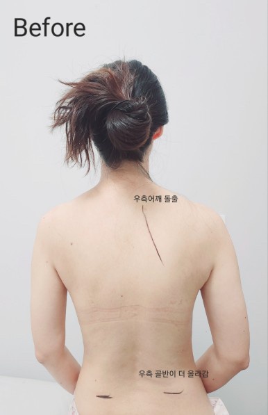 제대로체형관리 이미지