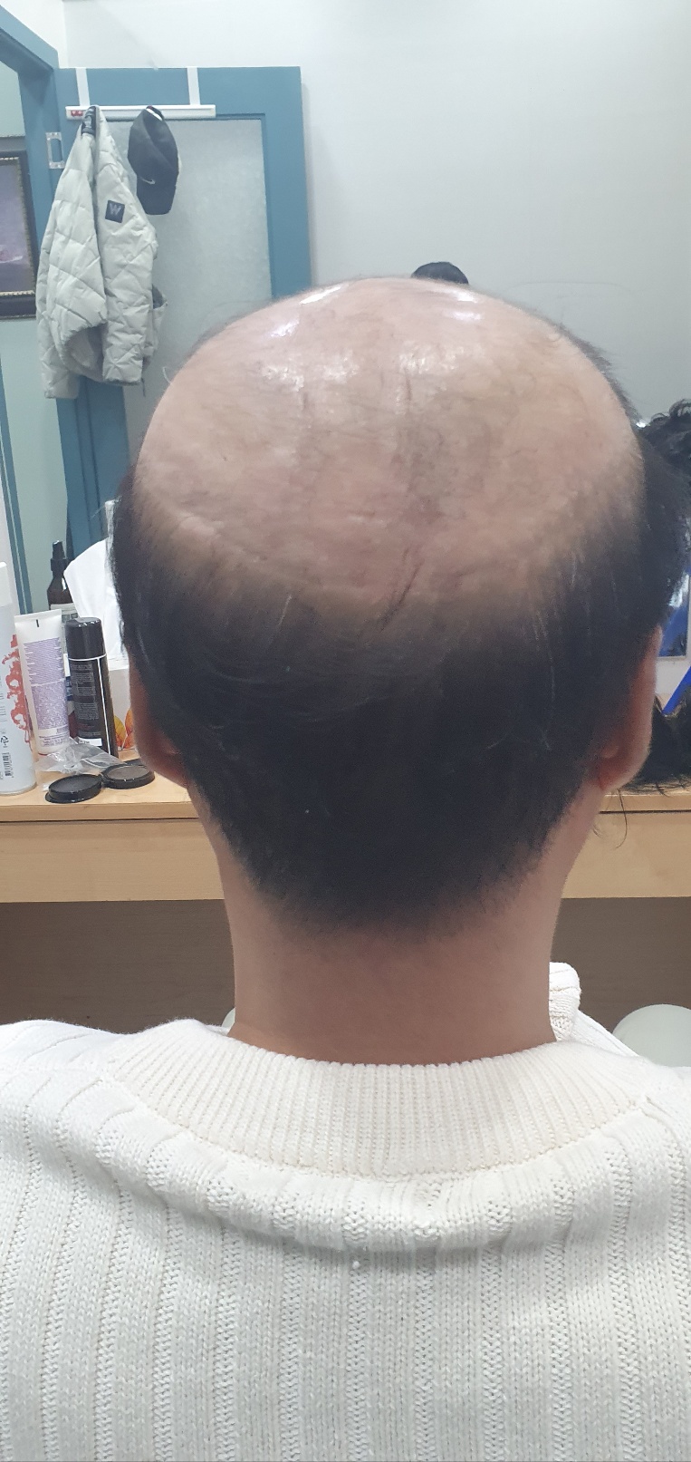 백가발 이미지