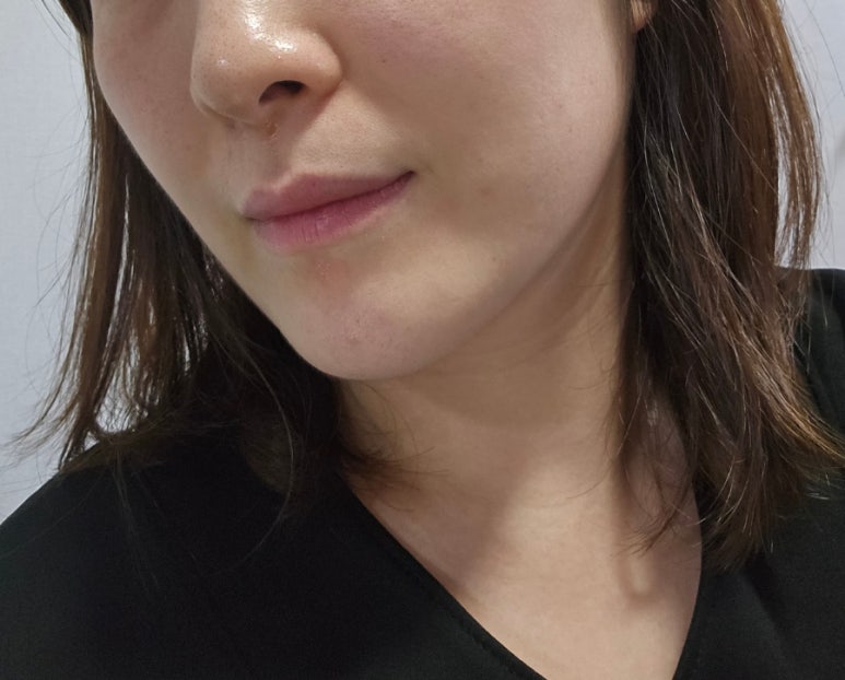 뷰드 이미지