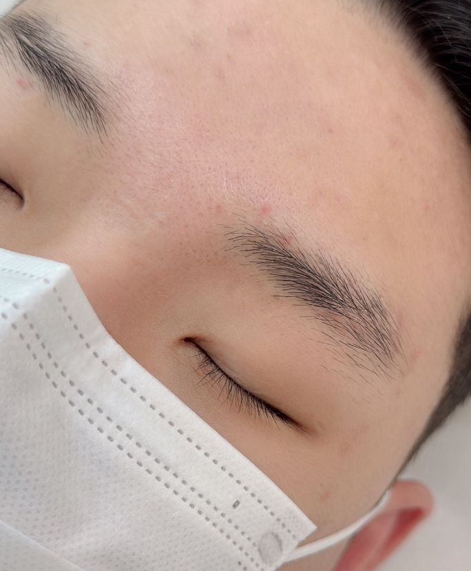 인브로우 이미지