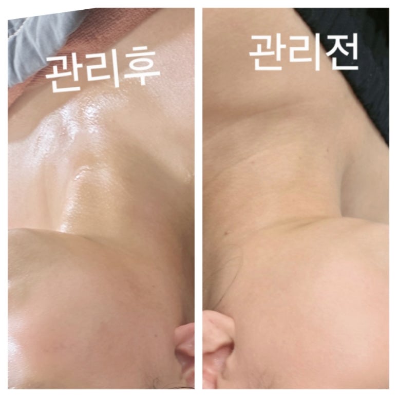 오늘은밝은피부 이미지