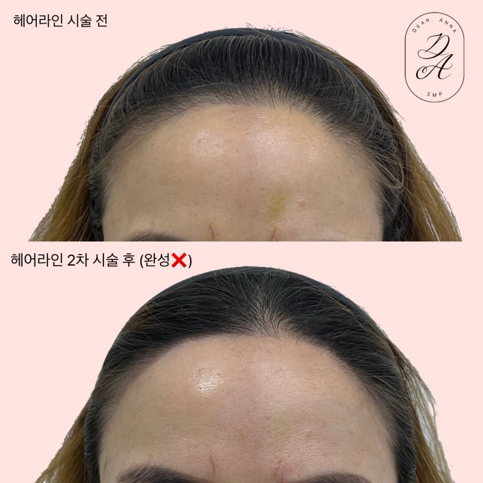 디어니즈 이미지