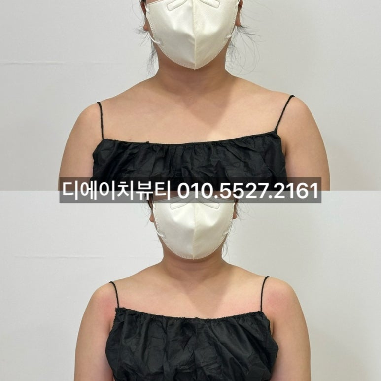 바른선 테라피 이미지