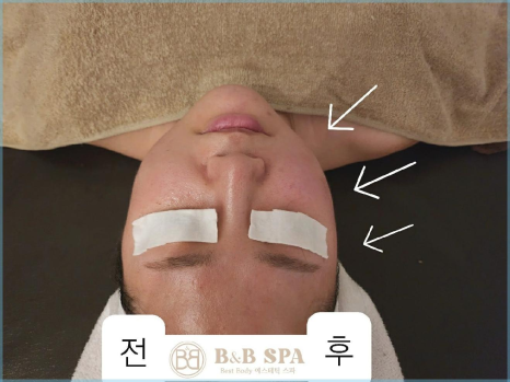 비앤비 에스테틱 이미지