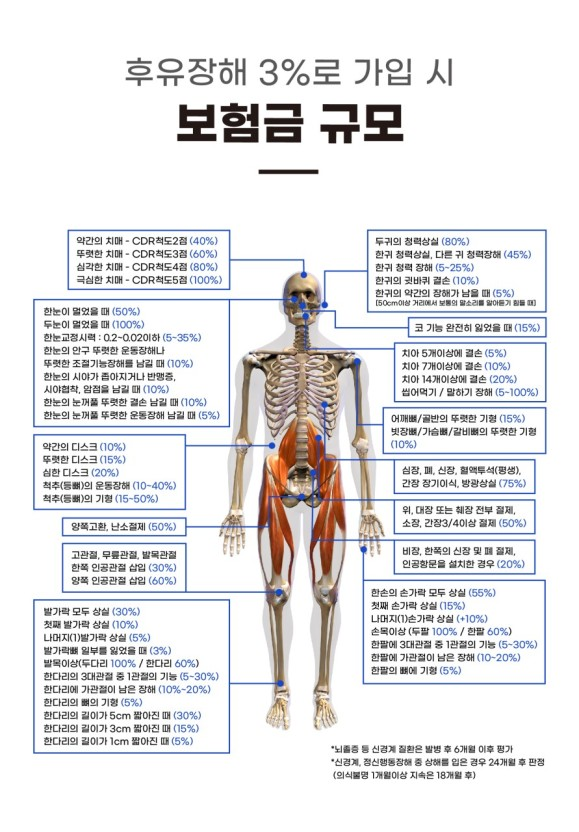 후유 이미지