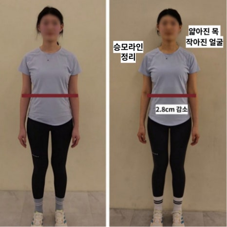 비벨라핏 이미지