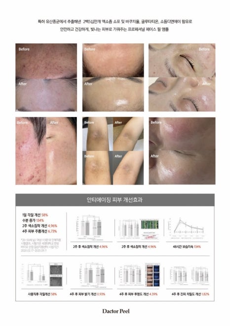 플라즈마 에스테틱 이미지