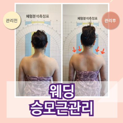 365뷰티라인 이미지