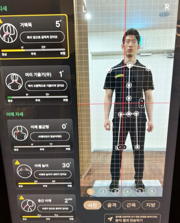 피트릭스 이미지
