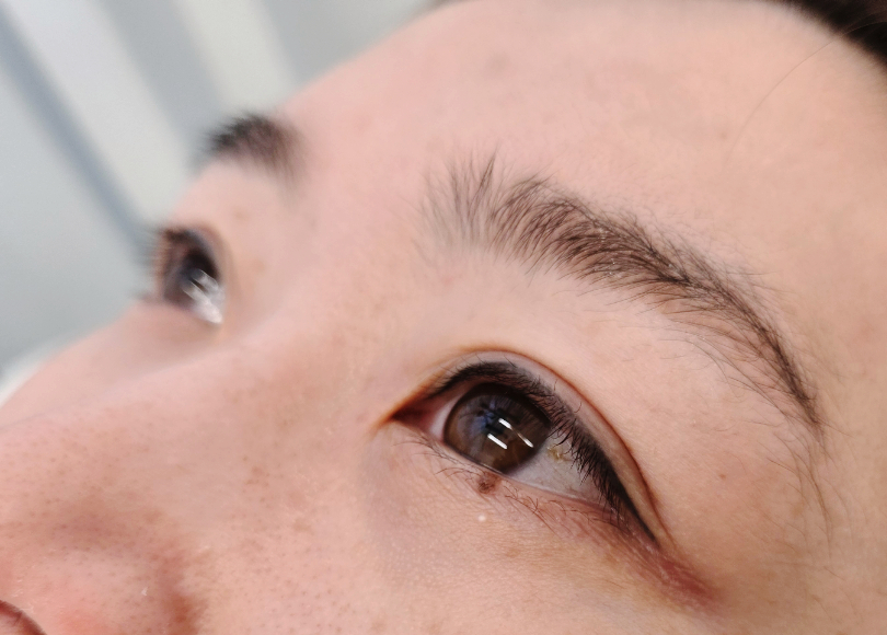 더예쁜eye 이미지