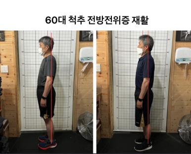 좋은교정 이미지