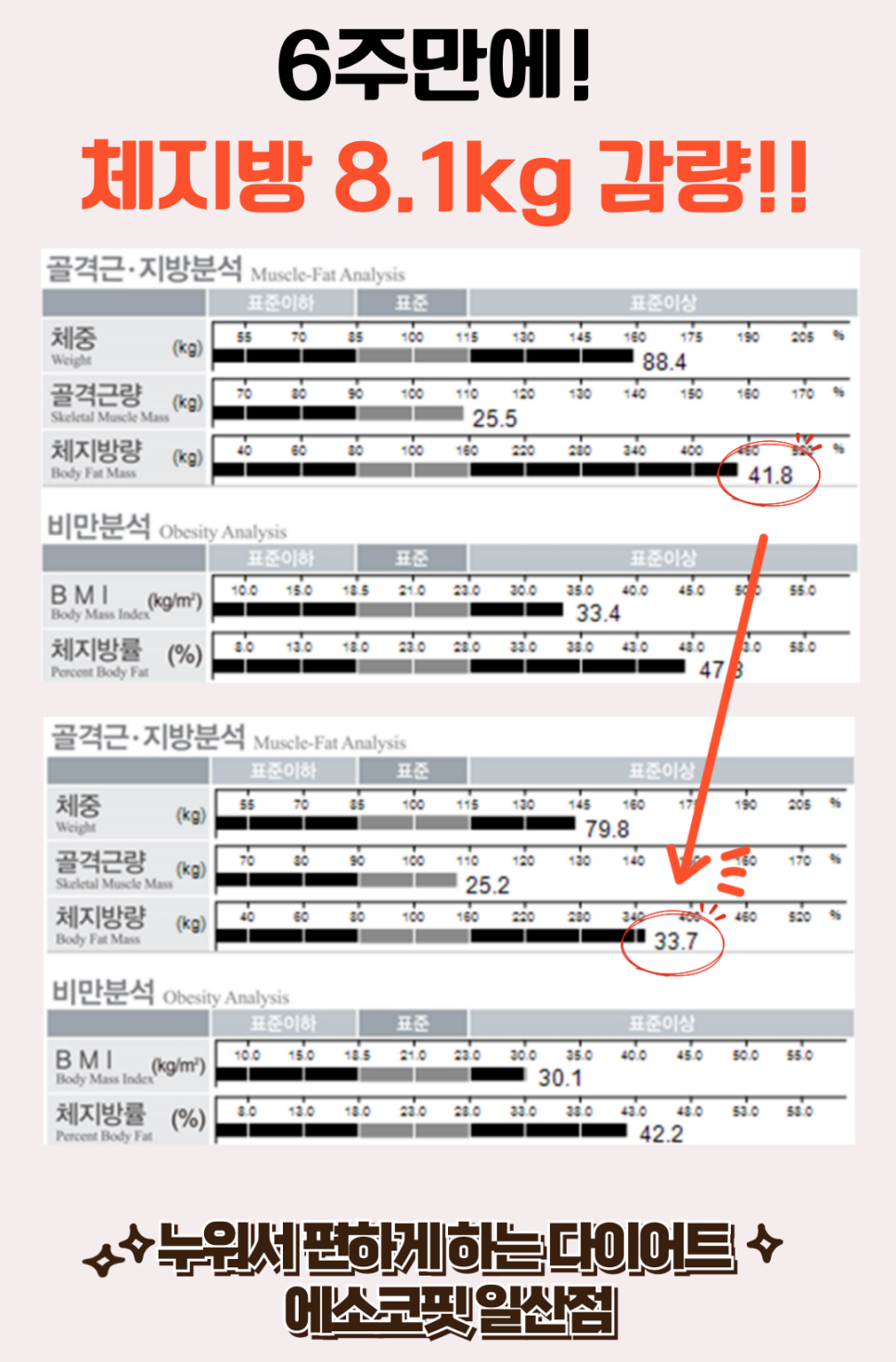 에소코핏 일산점 이미지