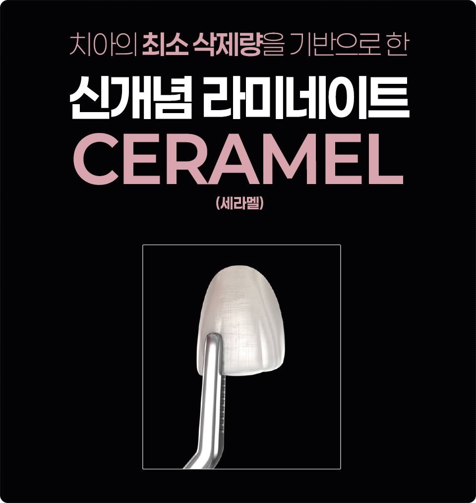 세라덴토 이미지