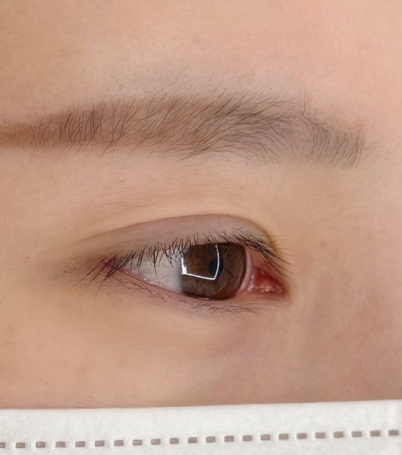 르아델왁싱속눈썹 이미지