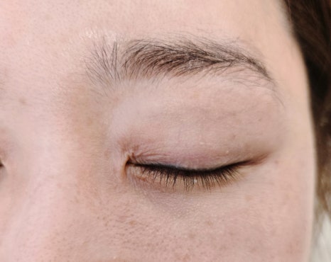 더예쁜eye 이미지