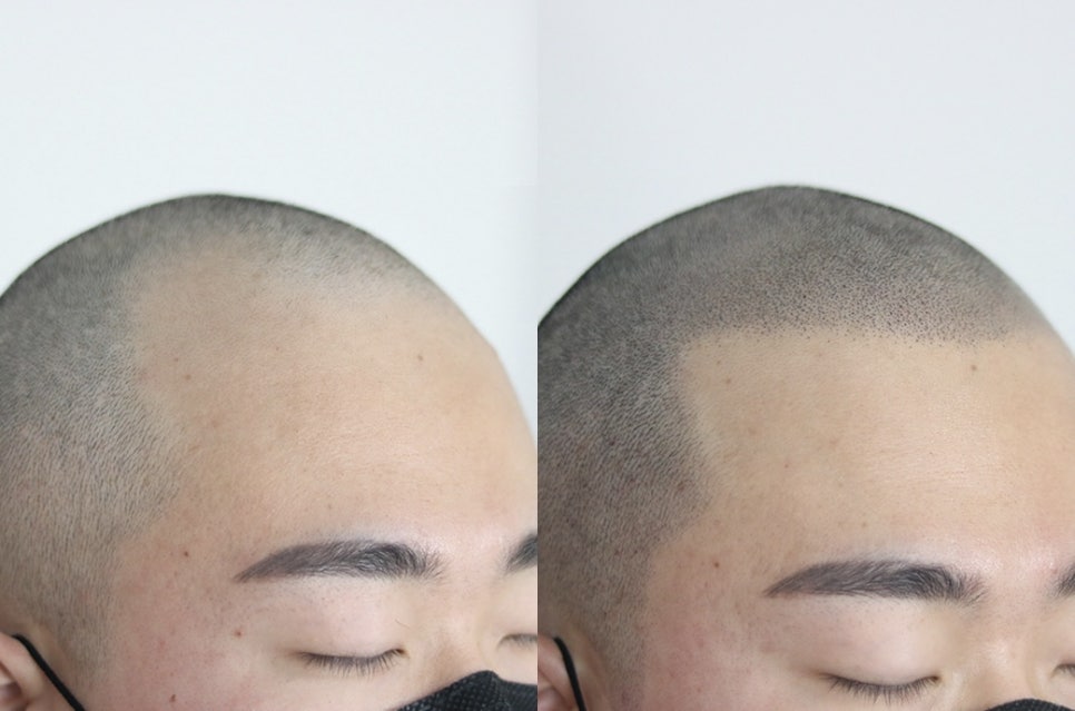 스칼프디자인센터 이미지