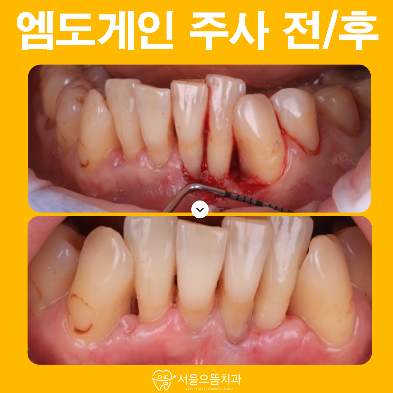 서울으뜸치과의원 이미지
