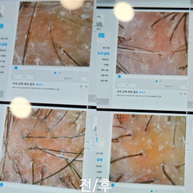 탈모케어존부산 이미지