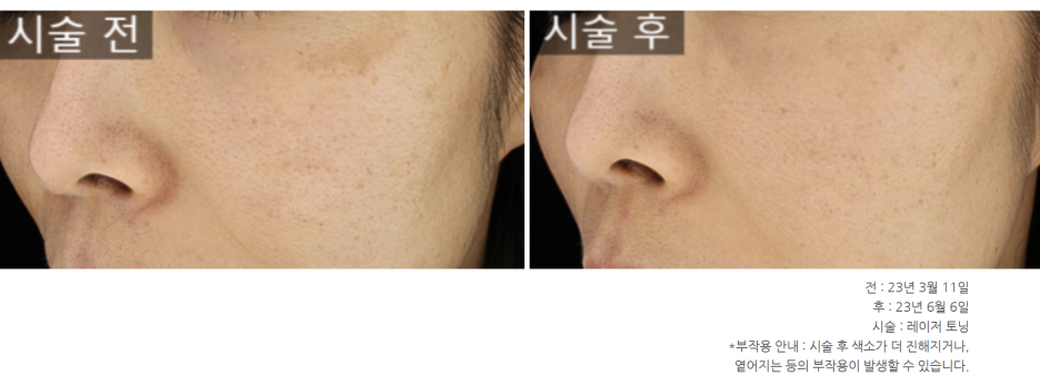광장피부과 이미지