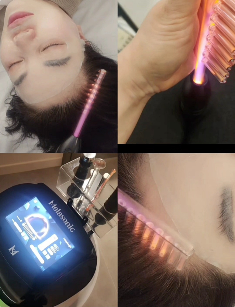 터치피부샵 이미지