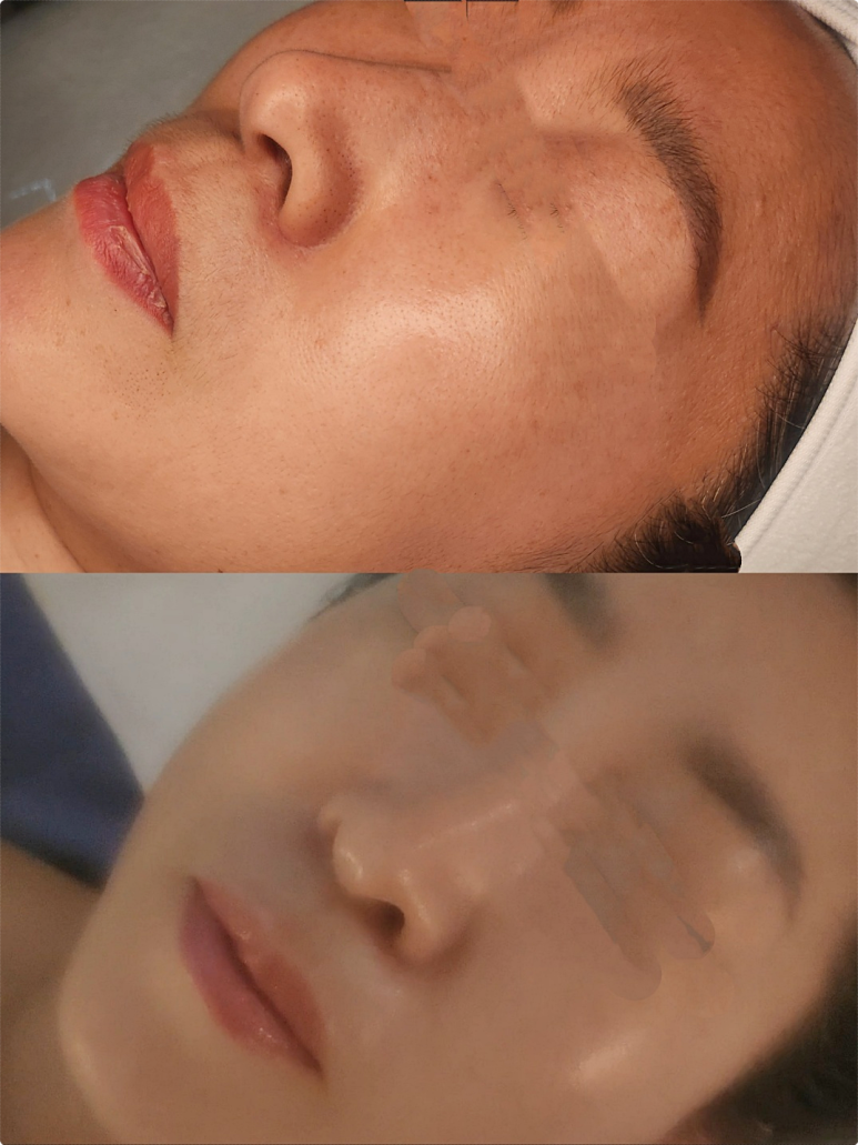 터치피부샵 이미지