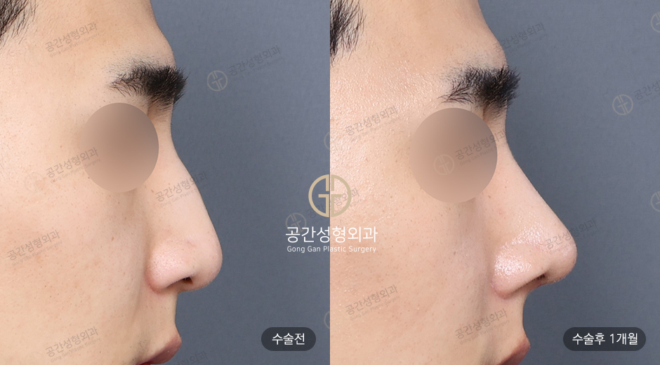 케이스코 이미지