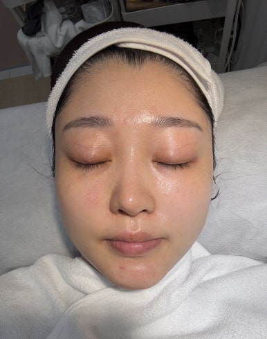 깐네일 이미지