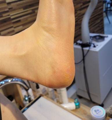 네일수아비 이미지