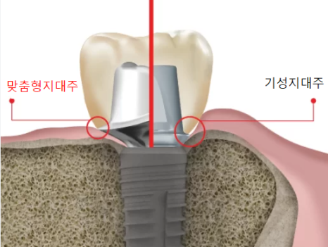배곧건치과 이미지