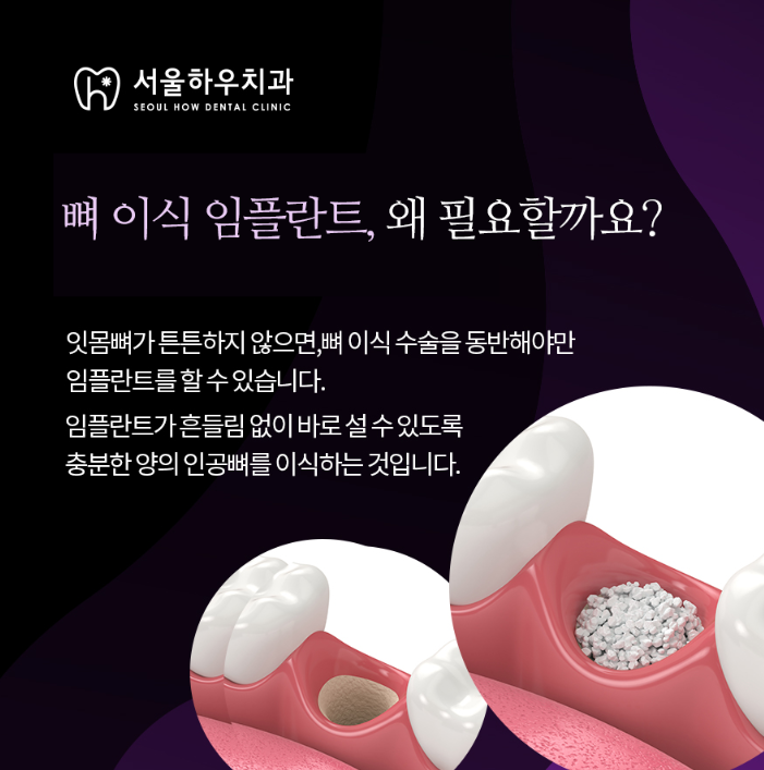 서울하우치과 이미지