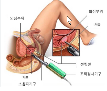 서비뇨기과의원 이미지