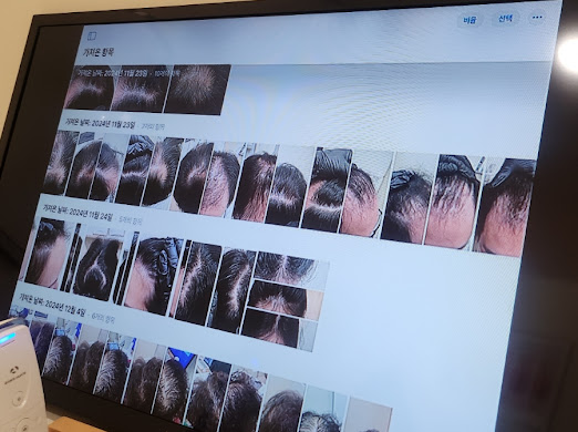 탈모케어존부산 이미지