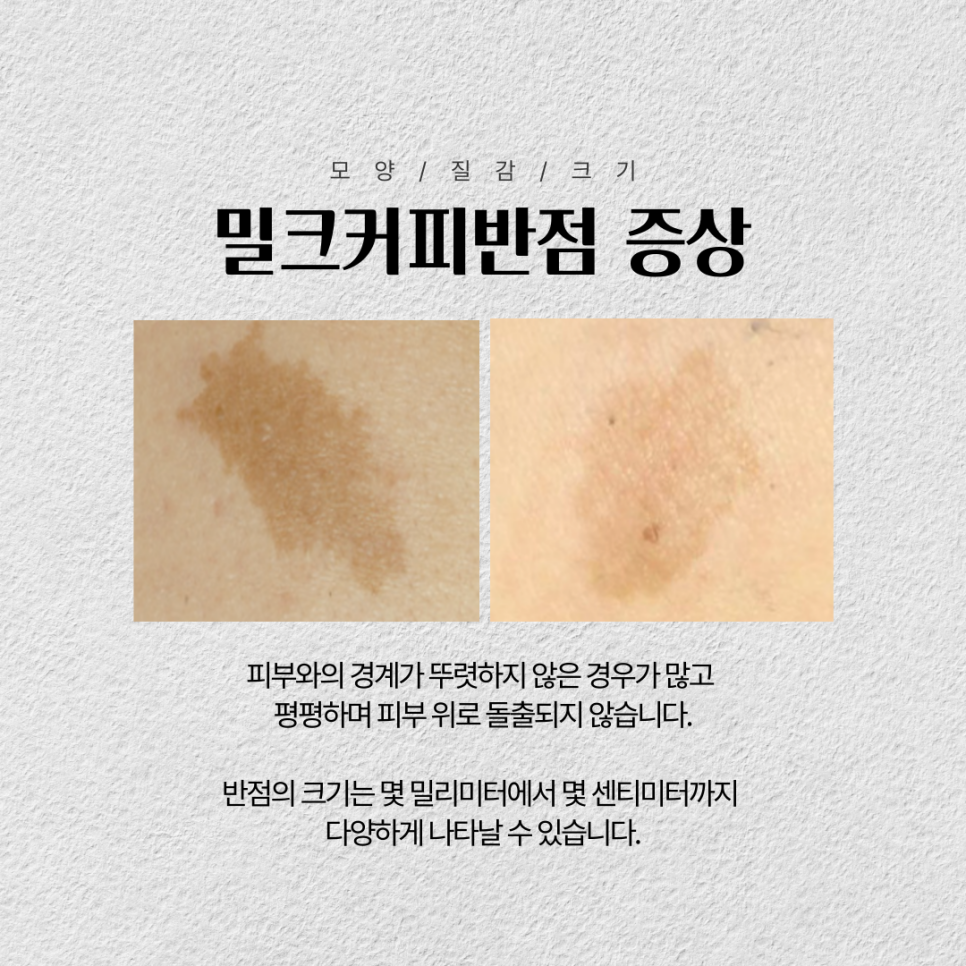 동일반점 이미지