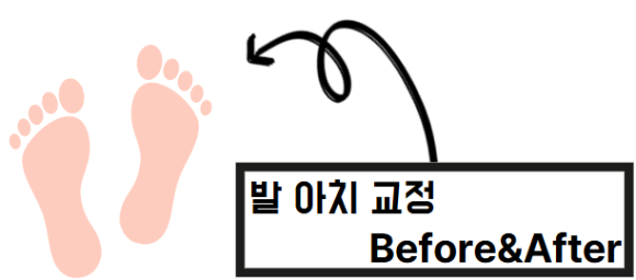 초이스핏 이미지