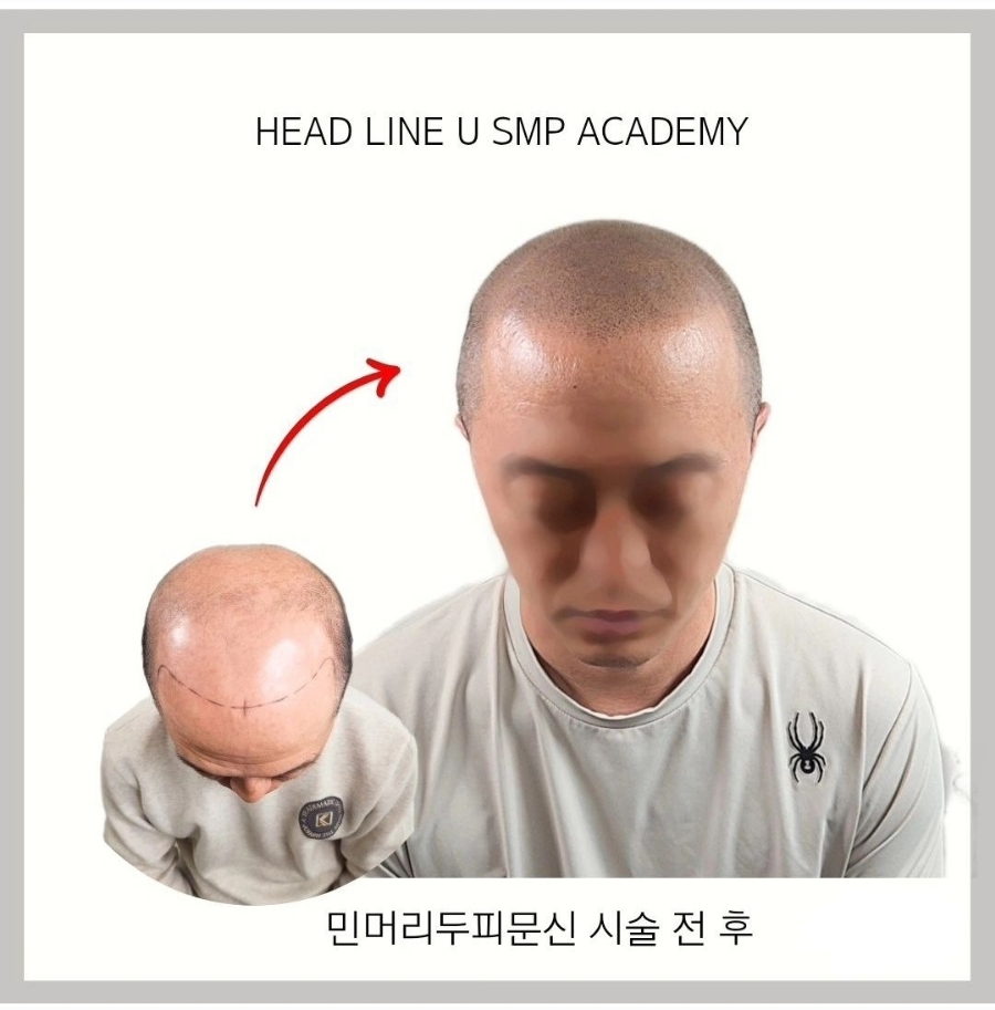헤드라인유 이미지
