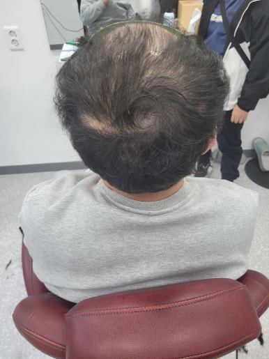 전주동안가발 이미지