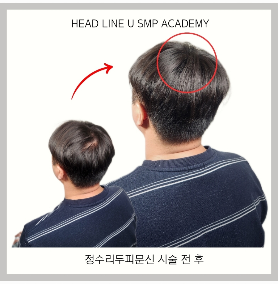 헤드라인유 이미지