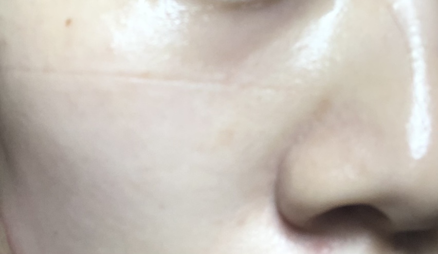 뉴로즈 이미지