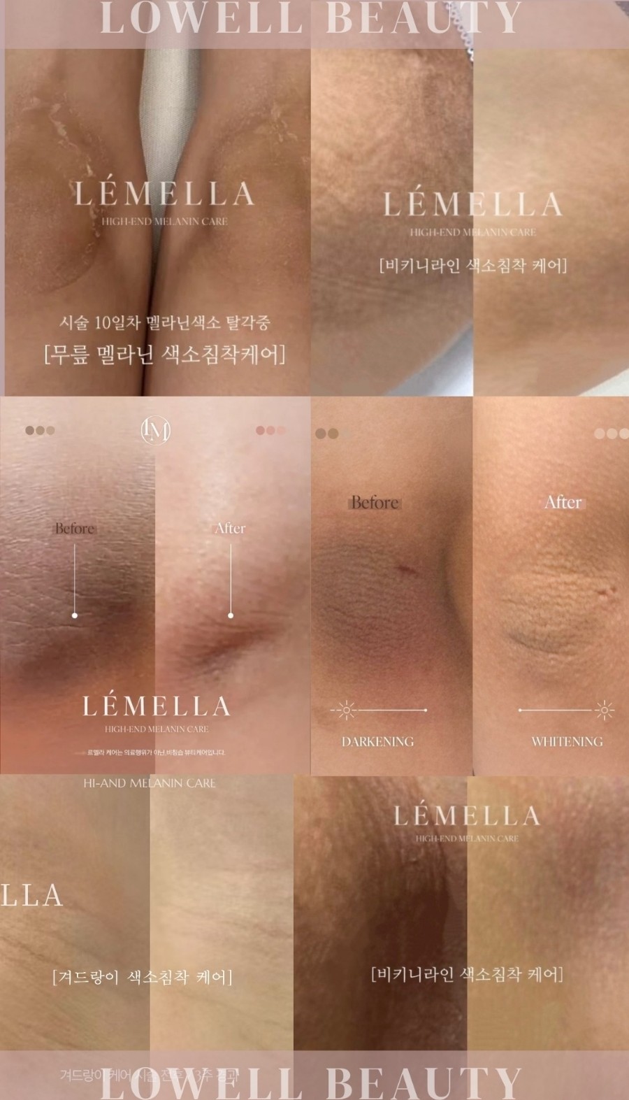 르로웰 이미지