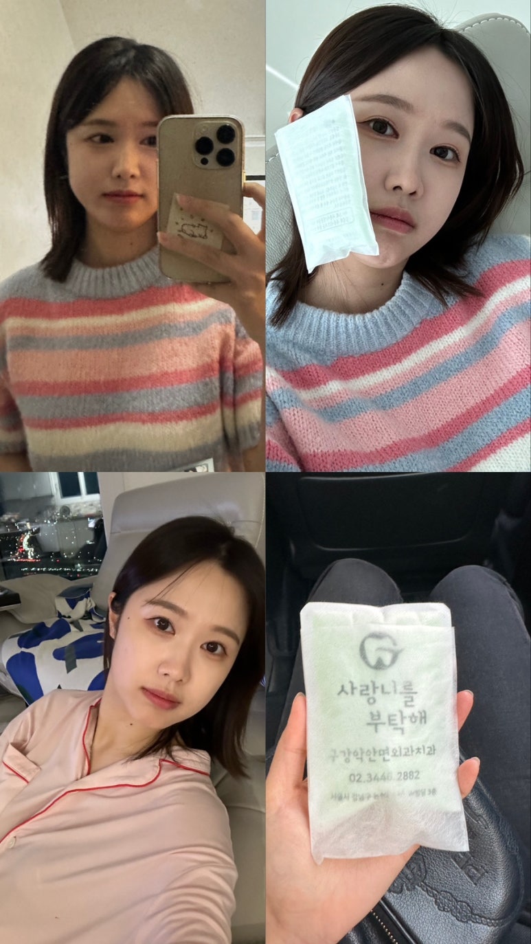 사랑니를부탁해치과 이미지