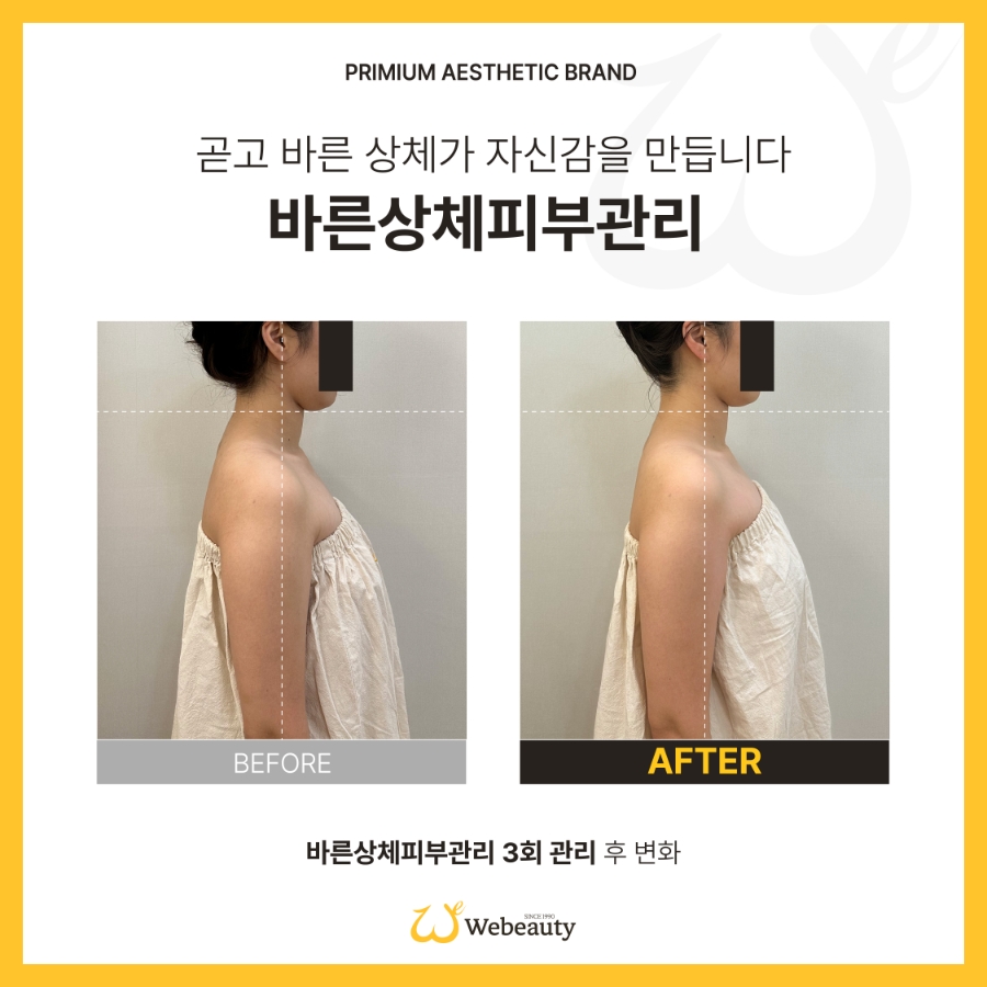 위뷰티 이미지