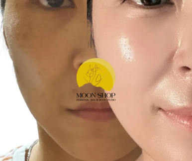 문샵 이미지