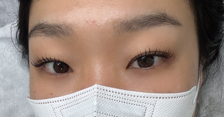 비니래쉬앤뷰티 이미지
